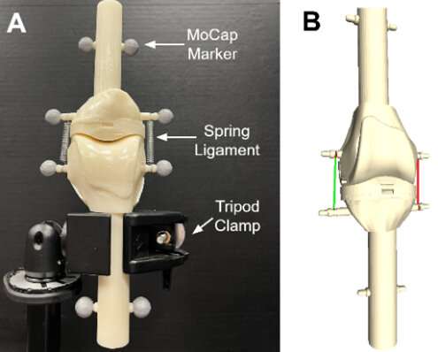 Knees up! Computational modeling could improve knee implant alignment