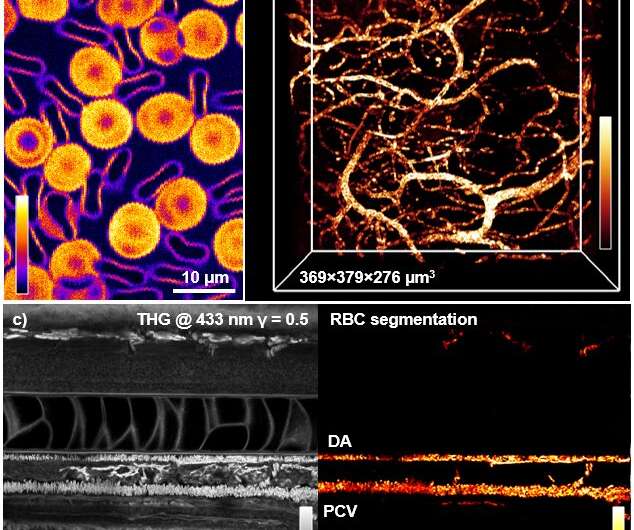 Label-free imaging of red blood cells and oxygenation with color TSFG microscopy