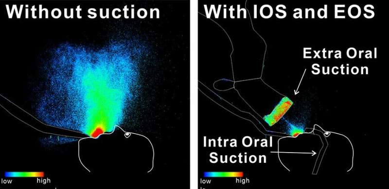 LED imaging visually confirms oral suction device efficacy in droplet and aerosol reduction