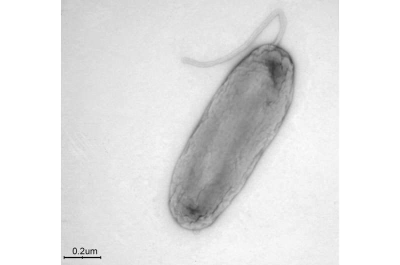 Legionella bononiensis: a new Legionella species has been identified