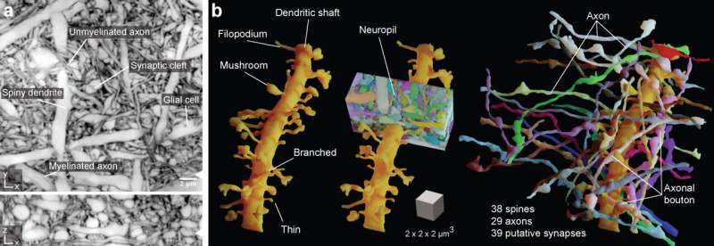 LIONESS redefines brain tissue imaging