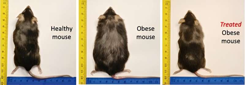 Liver-targeting drug reverses obesity, lowers cholesterol in mice