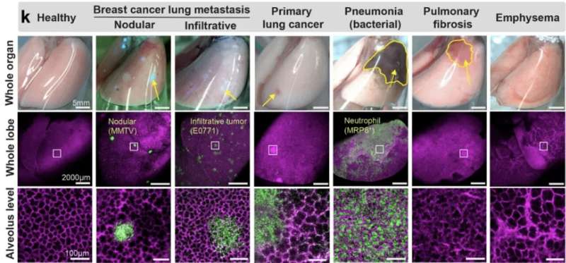 Lung research redefined: “crystal ribcage” technology pioneers new approaches