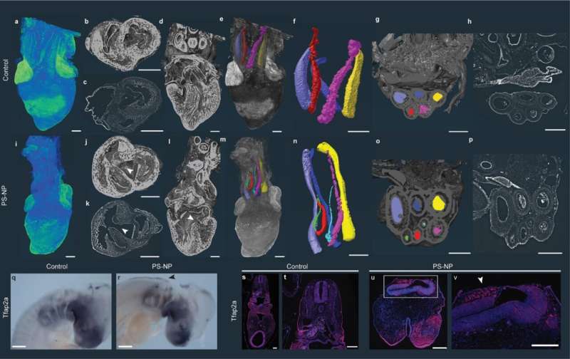 Malformations in heart, eyes and nervous system: Nano-plastics disrupt growth