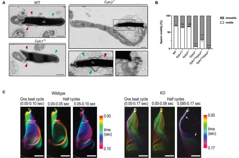 Malfunction in spermatogenesis: Researchers uncover contribution of cylicin proteins to male fertility