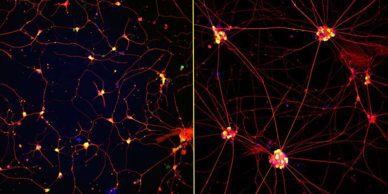 Mature 'lab grown' neurons hold promise for neurodegenerative disease