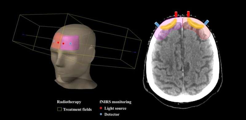 Measuring changes in brain tissue oxygenation for personalized cancer radiotherapy