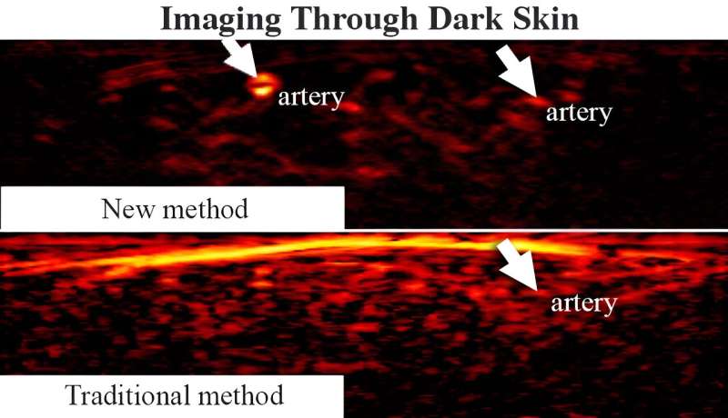 Medical imaging fails dark skin. Researchers fixed it