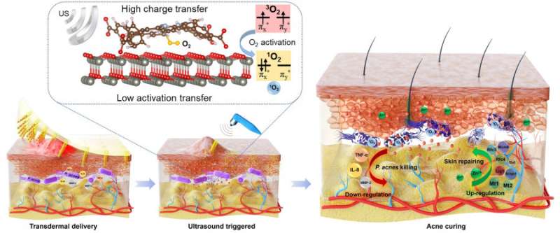 Micronaald-array ingebed met door ultrageluid geactiveerde antibacteriële nanodeeltjes voor de behandeling van huidinfecties