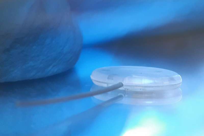 Minimally invasive smart glaucoma implants