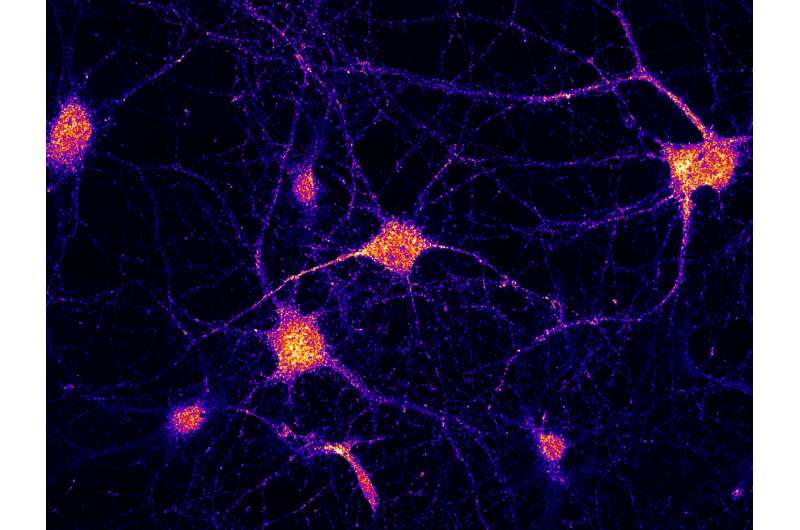 Missing link explains mRNA delivery in brain cells