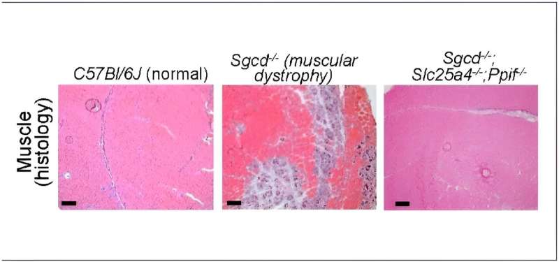 Mitochondria pore emerges as potential key to managing muscular dystrophies