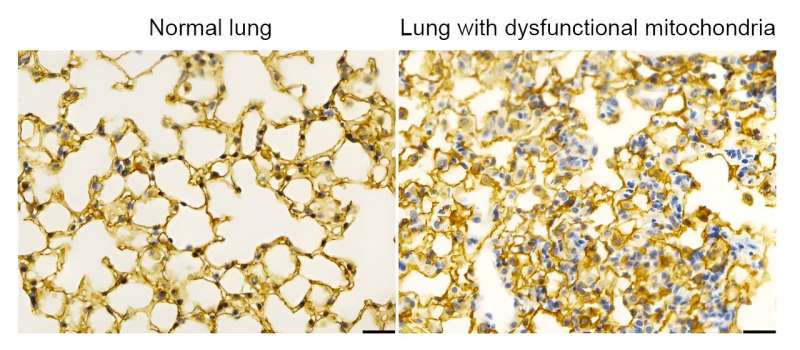Mitochondria regulate cellular signaling for proper lung development