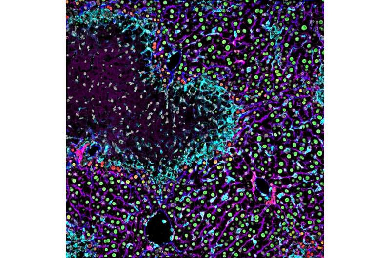 MoMFs could be central to liver regeneration
