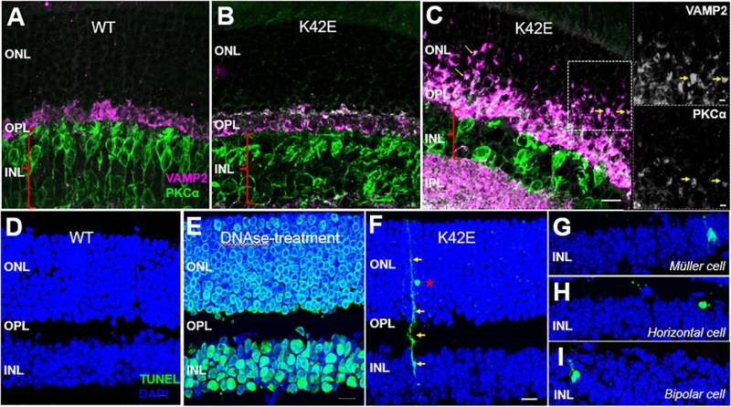 Mouse model of retinitis pigmentosa shows key biochemical, diagnostic features of human disease