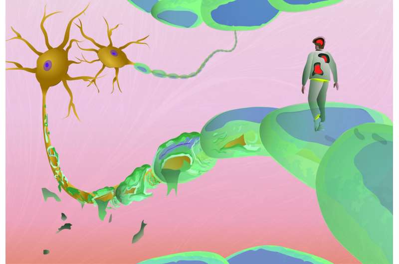 Esclerose múltipla: novo estudo destaca cinco sinais de alerta da doença