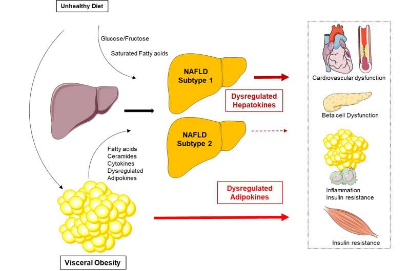 NAFLD - hepatokines mediate its impact on metabolic diseases and help to identify subtypes