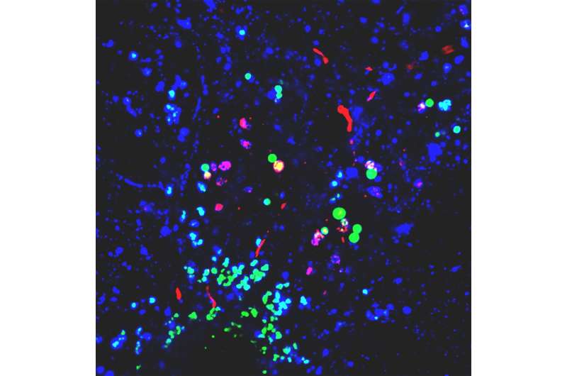 Nanoplastics promote conditions for Parkinson's across various lab models