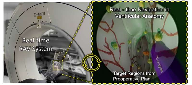 Navigational technology used in self-driving cars aids brain surgery visualization
