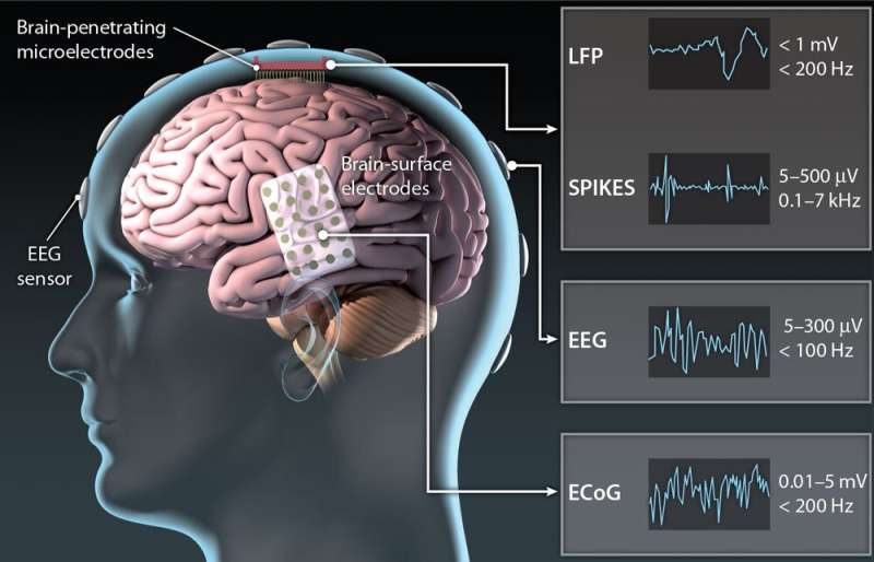 پروتز عصبی از فعالیت مغز برای رمزگشایی گفتار استفاده می کند