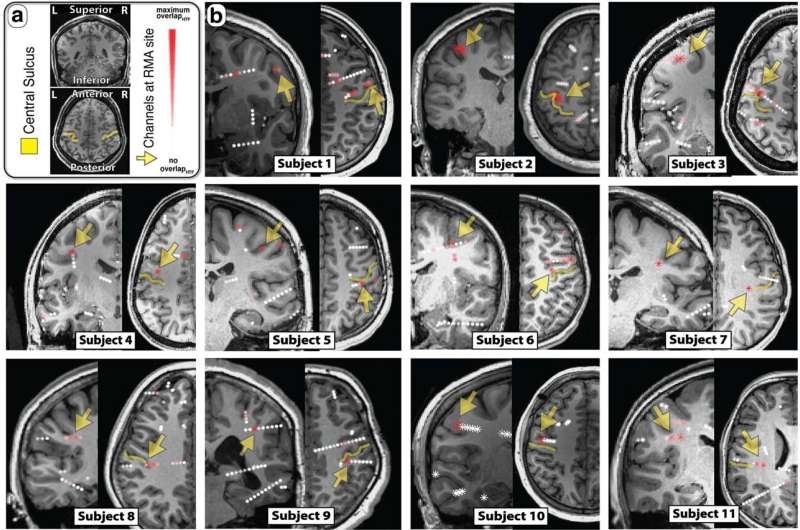 Neuroscientists discover brain area involved in movement