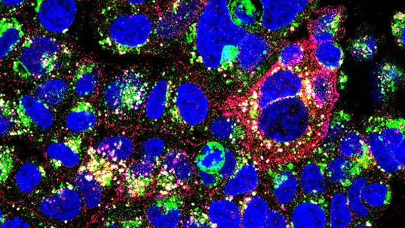 New antibody could target breast cancers