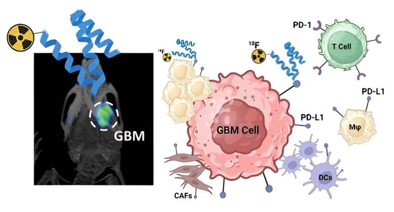 New approach to screening has potential to extend survival in glioblastoma brain cancer