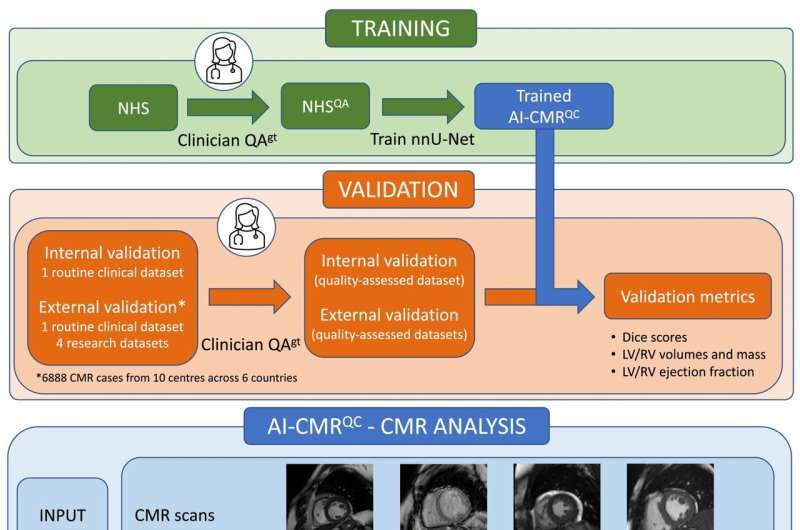 New artificial intelligence tool automates analysis of large-scale cardiac scan databases