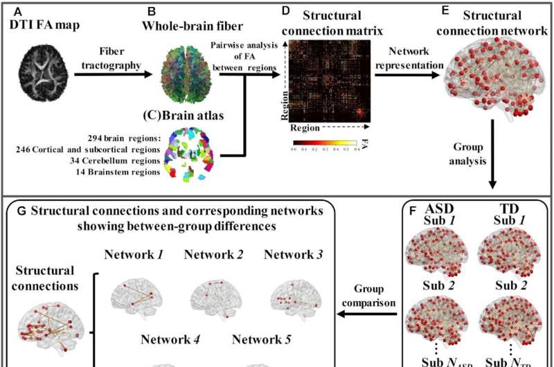 New brain connectivity biomarker offers accurate early diagnosis of Autism Spectrum Disorder (ASD)