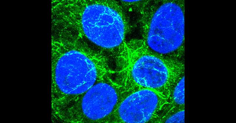 New cancer therapy target stops tumor cells from sharing resources