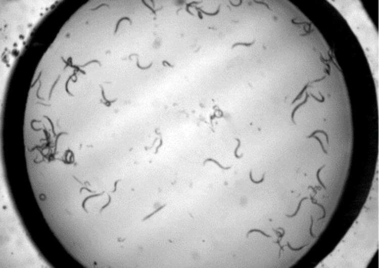 New 'gym-on-a-chip' for worms may lead to new Parkinson's treatments