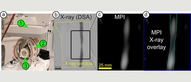New imaging technique without radioactive markers or radiation