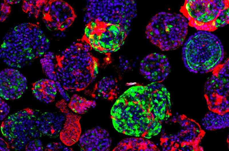 New insights into liver cancer using organoids