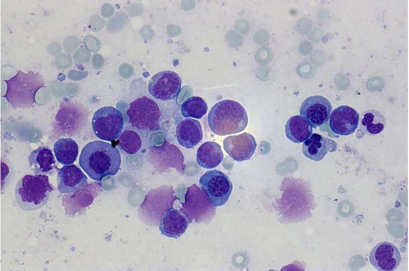 New insights into the genetic basis of leukemia