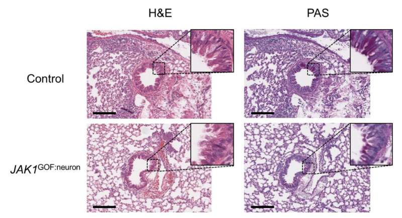 New insights revealed on tissue-dependent roles of JAK signaling in inflammation