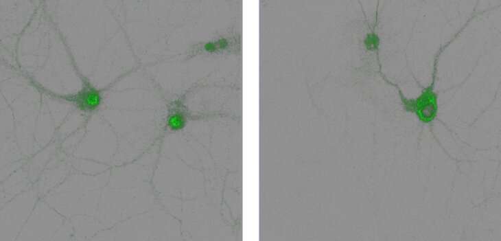 New mouse study reveals a key process in how the brain forms memories
