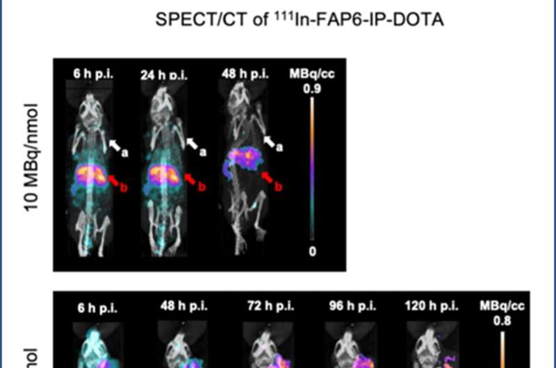 New Research: FAPI PET Imaging Superior for Diagnosing Multiple Types of Cancer, with Potential for Targeted Treatment