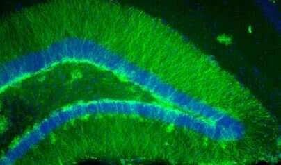 New research reveals clues about the development of epilepsy