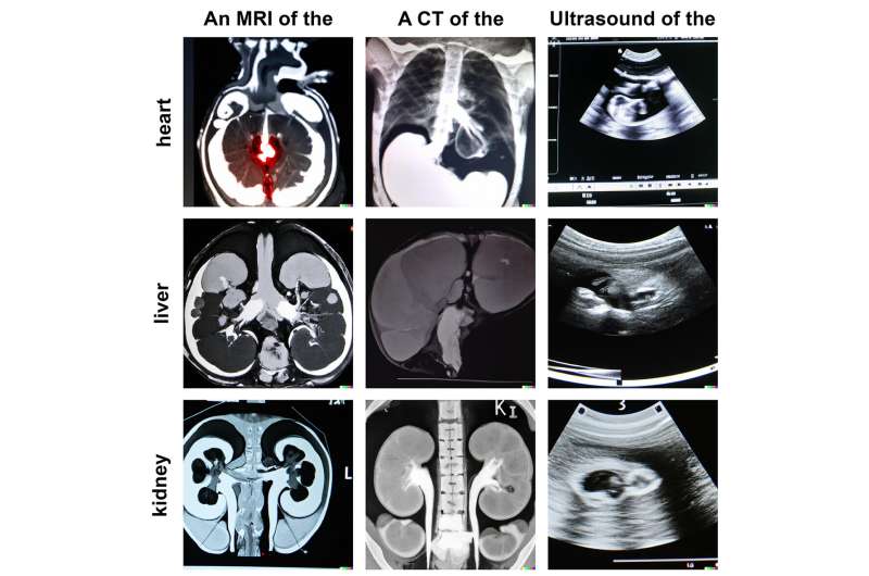 New research suggests AI image generation using DALL-E 2 has promising future in radiology