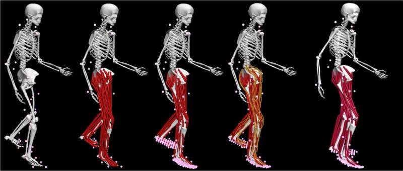 New software designs optimized, personalized treatments for movement impairments