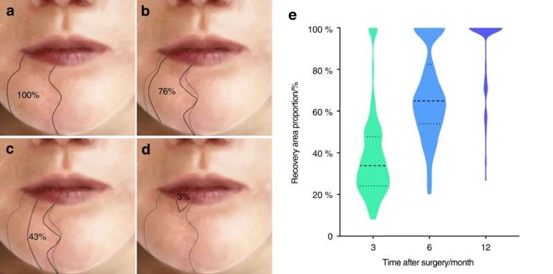 New study offers hope for sensory recovery in patients with lower lip numbness