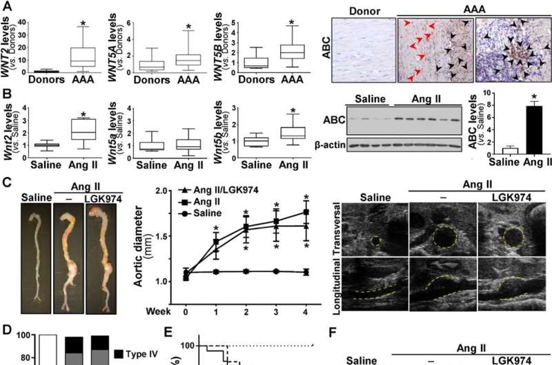 New study sheds light on the role of Wnt/β-catenin signaling in abdominal aortic aneurysm