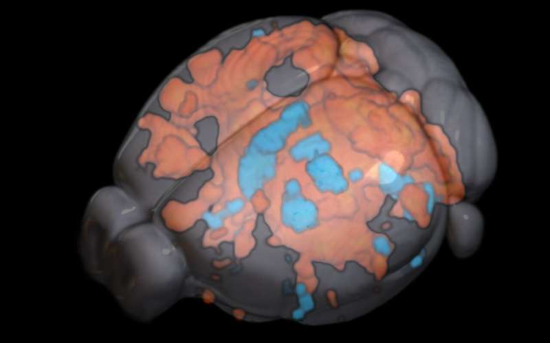 New technology may help inform brain stimulation