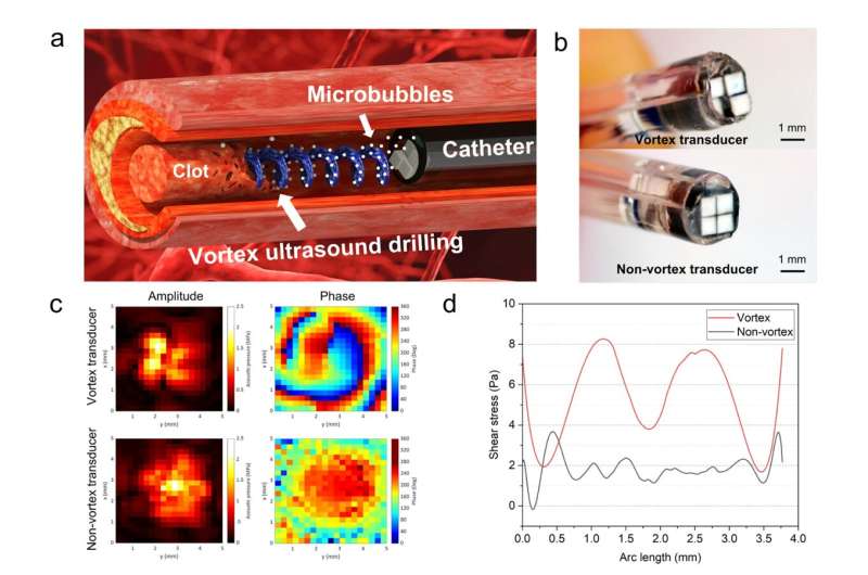 New tool uses ultrasound 'tornado' to break down blood clots
