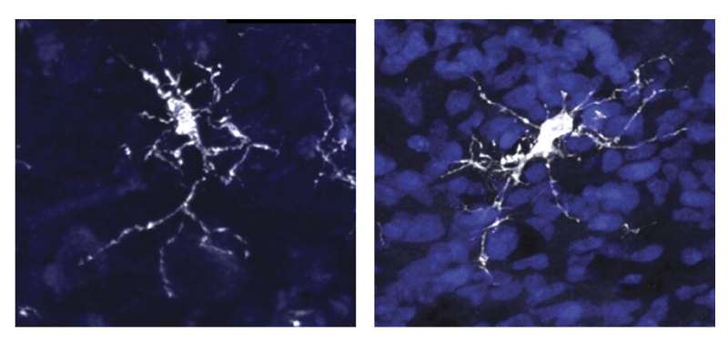 روشی جدید برای مدل سازی سلول های ایمنی مغز انسان