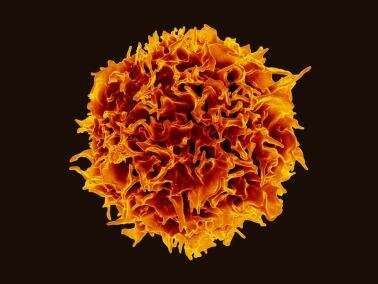 Pesquisadores do NIH descobrem novos detalhes sobre doenças imunológicas raras