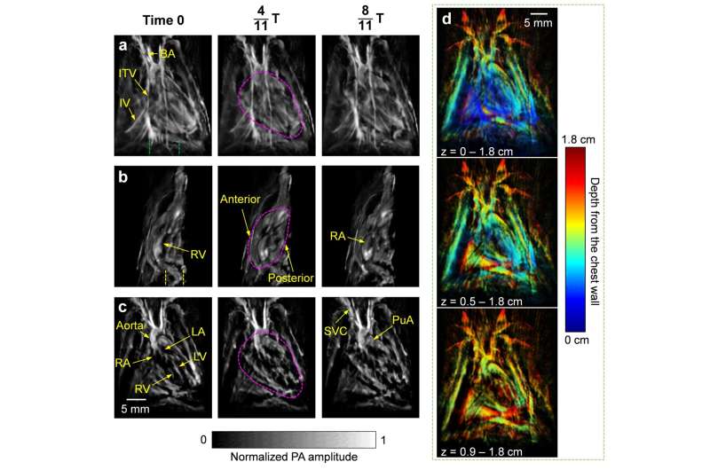 Non-invasive photoacoustic computed tomography of rat heart anatomy and function