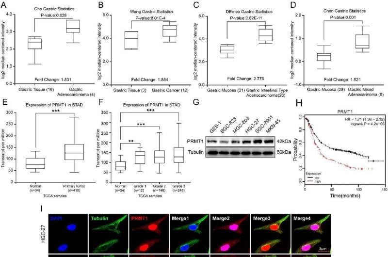 Novel mechanism uncovered: PRMT1 advances gastric cancer progression via β-catenin signaling