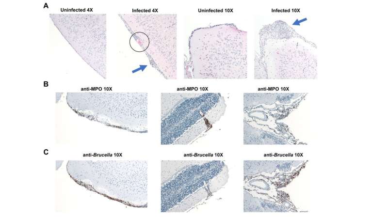 Novel mouse model may help to develop treatment for neurobrucellosis 