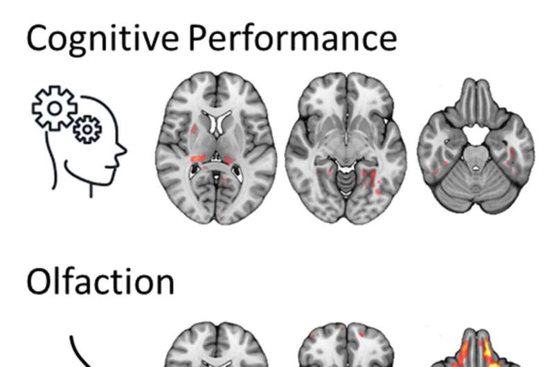 Novel MRI reveals brain changes in long-COVID patients